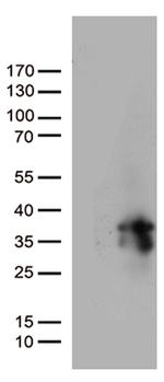 MGMT Antibody in Western Blot (WB)
