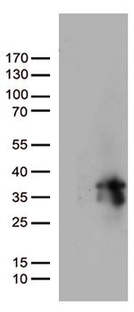 MGMT Antibody in Western Blot (WB)