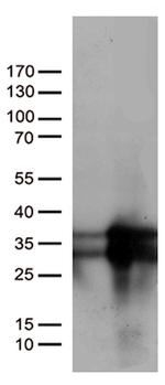 MGMT Antibody in Western Blot (WB)