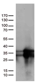 MGMT Antibody in Western Blot (WB)