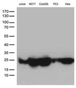 MGMT Antibody in Western Blot (WB)