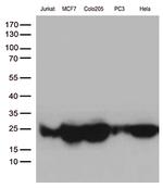MGMT Antibody in Western Blot (WB)