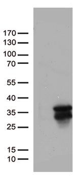 MGMT Antibody in Western Blot (WB)