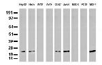 MGMT Antibody in Western Blot (WB)