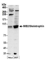 MIB2/Skeletrophin Antibody in Western Blot (WB)
