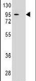 MIC-1 Antibody in Western Blot (WB)