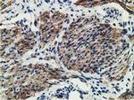 MICAL1 Antibody in Immunohistochemistry (Paraffin) (IHC (P))
