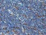MICAL1 Antibody in Immunohistochemistry (Paraffin) (IHC (P))