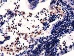 MICAL1 Antibody in Immunohistochemistry (Paraffin) (IHC (P))