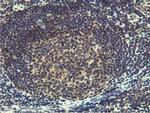 MIER2 Antibody in Immunohistochemistry (Paraffin) (IHC (P))