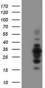 MIF4GD Antibody in Western Blot (WB)
