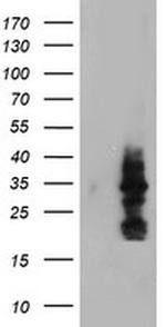 MIF4GD Antibody in Western Blot (WB)
