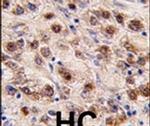 MINA53 Antibody in Immunohistochemistry (IHC)