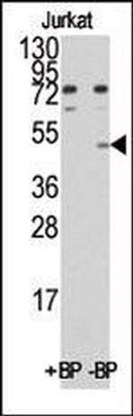 MINA53 Antibody in Western Blot (WB)