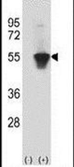 MINA53 Antibody in Western Blot (WB)