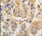 MIPEP Antibody in Immunohistochemistry (IHC)