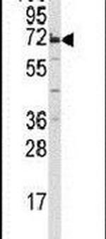 MIPEP Antibody in Western Blot (WB)
