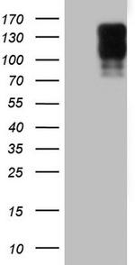 MKL1 Antibody in Western Blot (WB)