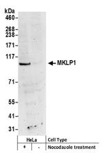 MKLP1 Antibody in Western Blot (WB)