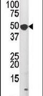 MNK1 Antibody in Western Blot (WB)