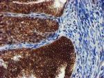 MKRN1 Antibody in Immunohistochemistry (Paraffin) (IHC (P))