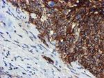 MKRN1 Antibody in Immunohistochemistry (Paraffin) (IHC (P))