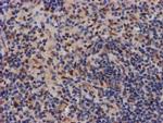 MKRN1 Antibody in Immunohistochemistry (Paraffin) (IHC (P))