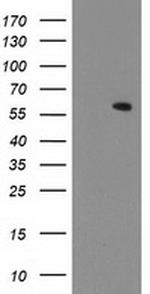 MKRN1 Antibody in Western Blot (WB)