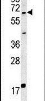 MKRN3 Antibody in Western Blot (WB)