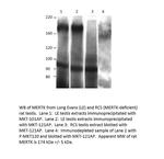 MERTK Polyclonal Antibody