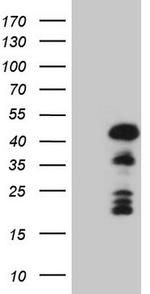 MKX Antibody in Western Blot (WB)