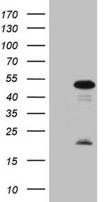 MKX Antibody in Western Blot (WB)