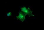 MLANA Antibody in Immunocytochemistry (ICC/IF)