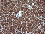 MLANA Antibody in Immunohistochemistry (Paraffin) (IHC (P))