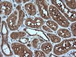 MLANA Antibody in Immunohistochemistry (Paraffin) (IHC (P))