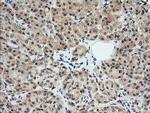 MLANA Antibody in Immunohistochemistry (Paraffin) (IHC (P))