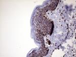 MLANA Antibody in Immunohistochemistry (Paraffin) (IHC (P))