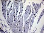 MLANA Antibody in Immunohistochemistry (Paraffin) (IHC (P))