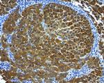 MLANA Antibody in Immunohistochemistry (Paraffin) (IHC (P))