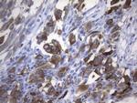 MLANA Antibody in Immunohistochemistry (Paraffin) (IHC (P))