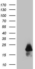 MLANA Antibody in Western Blot (WB)