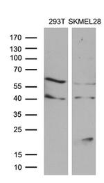 MLANA Antibody in Western Blot (WB)