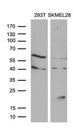 MLANA Antibody in Western Blot (WB)