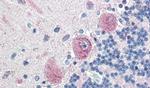 MLEC Antibody in Immunohistochemistry (Paraffin) (IHC (P))