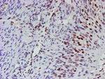 MLF1 Antibody in Immunohistochemistry (Paraffin) (IHC (P))