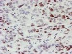 MLF1 Antibody in Immunohistochemistry (Paraffin) (IHC (P))