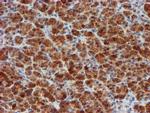 MLF1 Antibody in Immunohistochemistry (Paraffin) (IHC (P))
