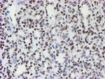 MLF1 Antibody in Immunohistochemistry (Paraffin) (IHC (P))
