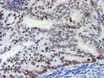 MLF1 Antibody in Immunohistochemistry (Paraffin) (IHC (P))