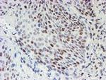 MLF1 Antibody in Immunohistochemistry (Paraffin) (IHC (P))